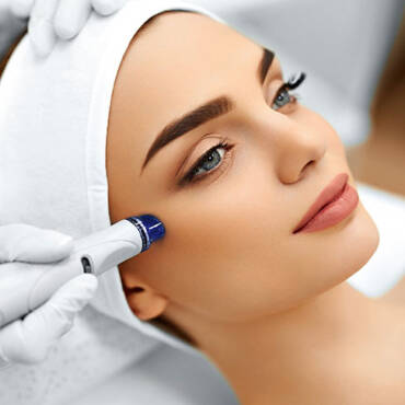 ricare-dettingen-microdermabrasion-start